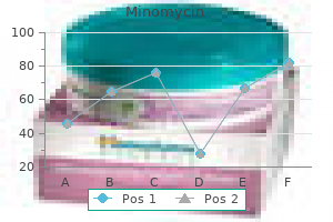 purchase minomycin online now