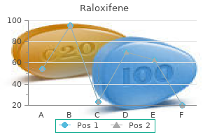 buy raloxifene 60mg without a prescription