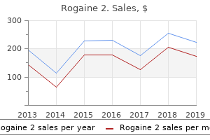 discount rogaine 2 60ml with visa