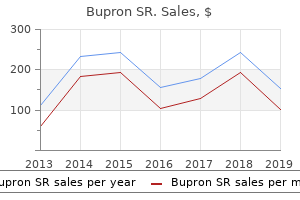 discount 150 mg bupron sr fast delivery